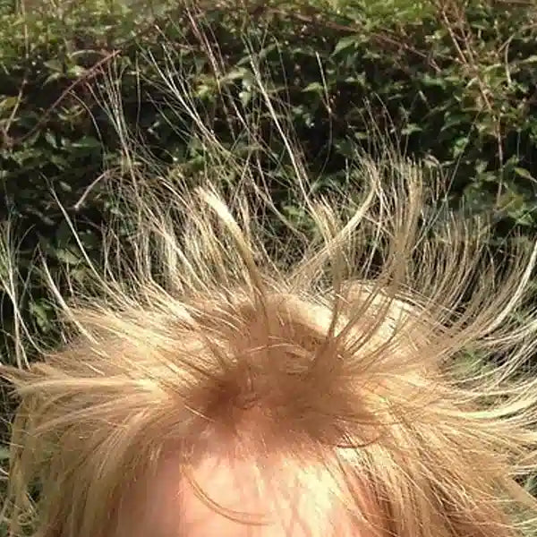 How to Avoid Static Electricity in Winter?