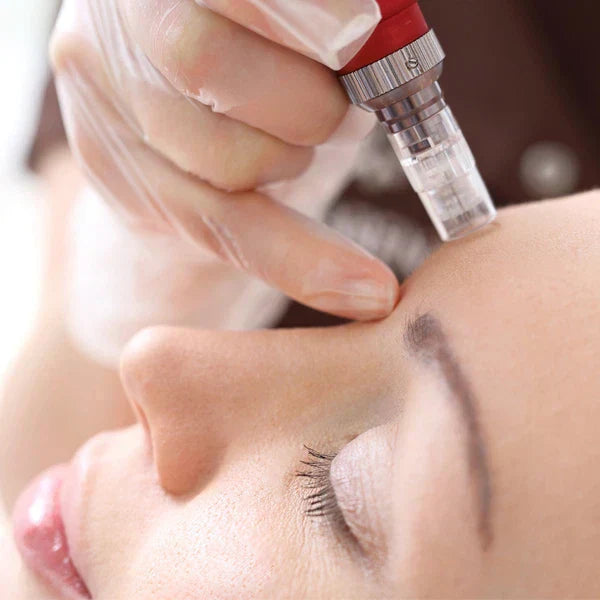 Red Light Therapy After Microneedling